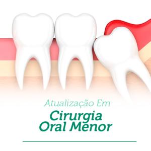 Curso de Cirurgia Oral Menor